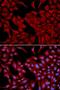 Dynactin Subunit 2 antibody, LS-C331980, Lifespan Biosciences, Immunofluorescence image 