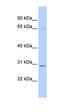 REL Proto-Oncogene, NF-KB Subunit antibody, orb329969, Biorbyt, Western Blot image 