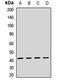 Cytokine receptor-like factor 2 antibody, LS-C668868, Lifespan Biosciences, Western Blot image 