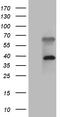 Zinc Finger FYVE-Type Containing 1 antibody, TA810182, Origene, Western Blot image 