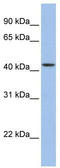 Zinc Finger Protein 202 antibody, TA333999, Origene, Western Blot image 