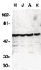 Caspase 10 antibody, PA5-19870, Invitrogen Antibodies, Western Blot image 