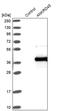 Ankyrin Repeat Domain 45 antibody, PA5-56809, Invitrogen Antibodies, Western Blot image 
