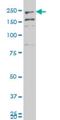 Myoferlin antibody, H00026509-A01, Novus Biologicals, Western Blot image 