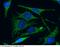 p33 antibody, 11874-MM04, Sino Biological, Immunohistochemistry paraffin image 