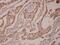 Kallikrein Related Peptidase 3 antibody, A01505-1, Boster Biological Technology, Immunohistochemistry paraffin image 