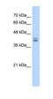 Transient Receptor Potential Cation Channel Subfamily C Member 6 antibody, orb329881, Biorbyt, Western Blot image 