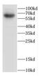 Calcium Voltage-Gated Channel Auxiliary Subunit Beta 4 antibody, FNab01176, FineTest, Western Blot image 
