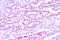 Dishevelled Binding Antagonist Of Beta Catenin 3 antibody, MBS200125, MyBioSource, Immunohistochemistry paraffin image 