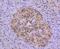 Histone Deacetylase 8 antibody, NBP2-67837, Novus Biologicals, Immunohistochemistry paraffin image 