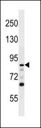 Doublecortin Like Kinase 1 antibody, LS-C100745, Lifespan Biosciences, Western Blot image 