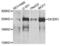 Dicer 1, Ribonuclease III antibody, LS-C334467, Lifespan Biosciences, Western Blot image 