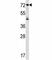 Interleukin 1 Receptor Type 1 antibody, F43419-0.4ML, NSJ Bioreagents, Western Blot image 