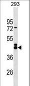 Calcium Release Activated Channel Regulator 2A antibody, LS-C159509, Lifespan Biosciences, Western Blot image 