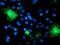 Serine Peptidase Inhibitor, Kunitz Type 1 antibody, LS-C787064, Lifespan Biosciences, Immunofluorescence image 