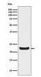 Retinol Binding Protein 4 antibody, M01089, Boster Biological Technology, Western Blot image 