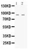 Ubiquitin Like With PHD And Ring Finger Domains 2 antibody, PB9906, Boster Biological Technology, Western Blot image 