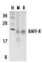 TNF Receptor Superfamily Member 13C antibody, NBP1-77234, Novus Biologicals, Western Blot image 