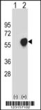 Pyruvate Dehydrogenase E1 Alpha 1 Subunit antibody, 64-050, ProSci, Western Blot image 