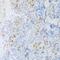 Calcium Release Activated Channel Regulator 2A antibody, GTX66215, GeneTex, Immunohistochemistry paraffin image 