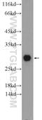 Calbindin 1 antibody, 14479-1-AP, Proteintech Group, Western Blot image 