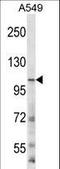 Glutamate [NMDA] receptor subunit 3B antibody, LS-C166680, Lifespan Biosciences, Western Blot image 