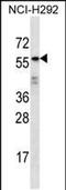 Outer Dense Fiber Of Sperm Tails 2 Like antibody, PA5-48495, Invitrogen Antibodies, Western Blot image 