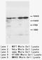 Rho Associated Coiled-Coil Containing Protein Kinase 2 antibody, LS-C172063, Lifespan Biosciences, Western Blot image 