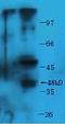 Potassium Voltage-Gated Channel Subfamily J Member 6 antibody, orb4624, Biorbyt, Western Blot image 