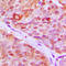 Zinc Finger Protein 148 antibody, LS-C358401, Lifespan Biosciences, Immunohistochemistry paraffin image 