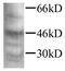 Neurofilament Light antibody, GTX42519, GeneTex, Western Blot image 