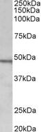 Terminal Uridylyl Transferase 4 antibody, 42-885, ProSci, Enzyme Linked Immunosorbent Assay image 