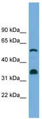 Cytochrome P450 Family 26 Subfamily B Member 1 antibody, TA344812, Origene, Western Blot image 