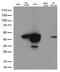 MAGE Family Member A4 antibody, M07175-1, Boster Biological Technology, Western Blot image 