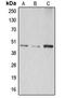 Abhydrolase Domain Containing 8 antibody, LS-C353548, Lifespan Biosciences, Western Blot image 