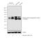 Calcium/Calmodulin Dependent Protein Kinase II Beta antibody, PA5-37833, Invitrogen Antibodies, Western Blot image 