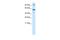 Septin-4 antibody, A09411, Boster Biological Technology, Western Blot image 