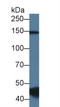 Probable RNA-binding protein 20 antibody, LS-C297396, Lifespan Biosciences, Western Blot image 