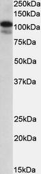 SATB Homeobox 1 antibody, EB09448, Everest Biotech, Western Blot image 