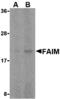 Fas Apoptotic Inhibitory Molecule antibody, A10908, Boster Biological Technology, Western Blot image 