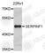 Serpin Family F Member 1 antibody, A1673, ABclonal Technology, Western Blot image 