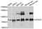 Potassium Voltage-Gated Channel Modifier Subfamily V Member 2 antibody, A10340, ABclonal Technology, Western Blot image 
