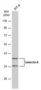 Galectin 8 antibody, GTX117687, GeneTex, Western Blot image 