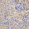 Complement Factor B antibody, STJ23103, St John