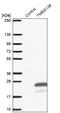 Transmembrane Protein 138 antibody, NBP1-92528, Novus Biologicals, Western Blot image 