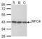 Replication Factor C Subunit 4 antibody, PA5-21538, Invitrogen Antibodies, Western Blot image 
