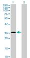 Phospholipase B Domain Containing 1 antibody, H00079887-B01P, Novus Biologicals, Western Blot image 