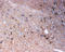 Tenascin R antibody, LS-C312845, Lifespan Biosciences, Immunohistochemistry paraffin image 