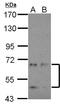 Cyclin Dependent Kinase Like 3 antibody, LS-C155218, Lifespan Biosciences, Western Blot image 