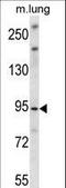 Unc-45 Myosin Chaperone B antibody, LS-C160434, Lifespan Biosciences, Western Blot image 